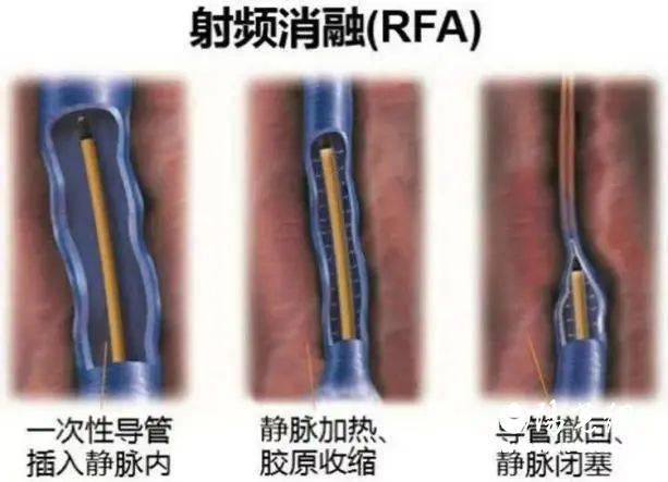 b50c9147a8fb4a6ab0bad59eff16ac89