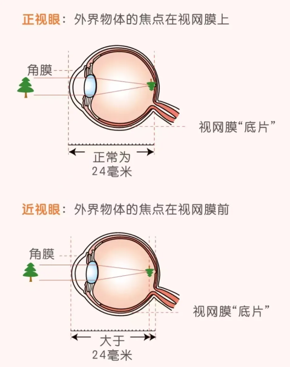 说明: f820cf7e2d9d1daa053d1e3d0534de20d79e5c71