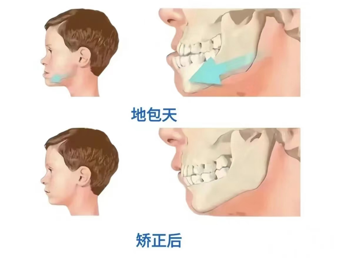 说明: c282430ee724751d6457a2c4843d3ae3