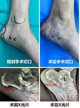 说明: 8aedbd4a954fbc238024a84d3f8fcea